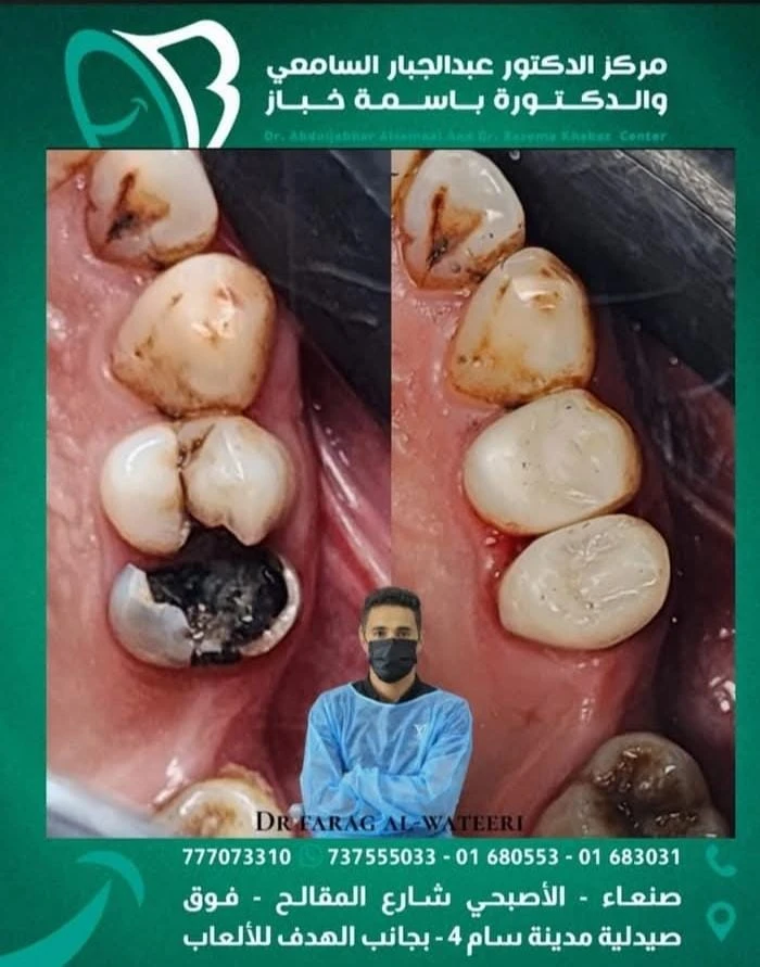 مركز الدكتور عبدالجبار السامعي